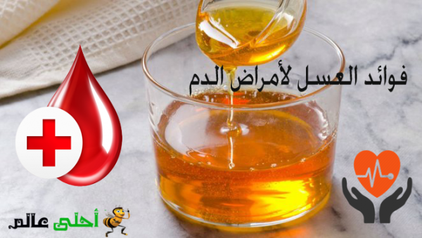 فوائد العسل لأمراض الدم, العسل, فوائد العسل,العسل للدم, علاج أمراض الدم, النحل, موقع نحلة , احلى عالم, عسل, الدم والعسل, فوائد العسل للقلب, العسل للقلب, العسل لمرض الدم
